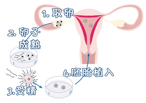 爱心同性供卵代孕微信群